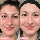 Pore Minimising Kit Thumb 3