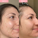 Pro Youth Dark Spot Serum Thumb 2